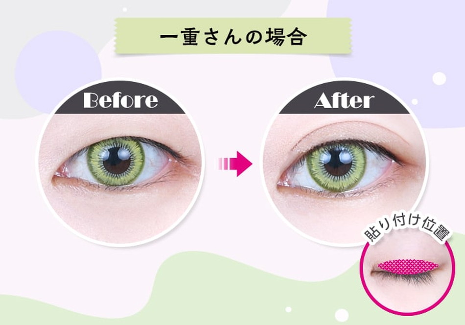 アシストAssist 二重メッシュAS 幅広タイプ(二重整形用メッシュシート)LP画像3