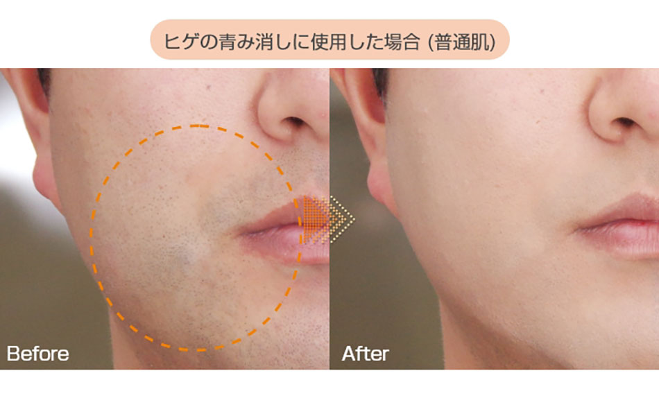 アシストAssist オレンジコンシーラーASヒゲの青み消しに使用した場合|コスプレカラコン通販アイトルテ